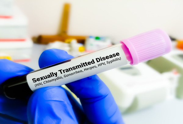 Aumentan casos de enfermedades venéreas entre europeos