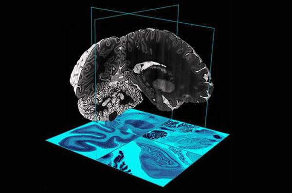 Crean el primer mapa tridimensional de una parte del cerebro de un mamífero