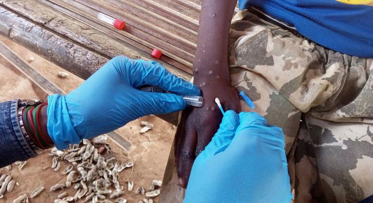 La OMS mantiene la emergencia internacional por la mpox