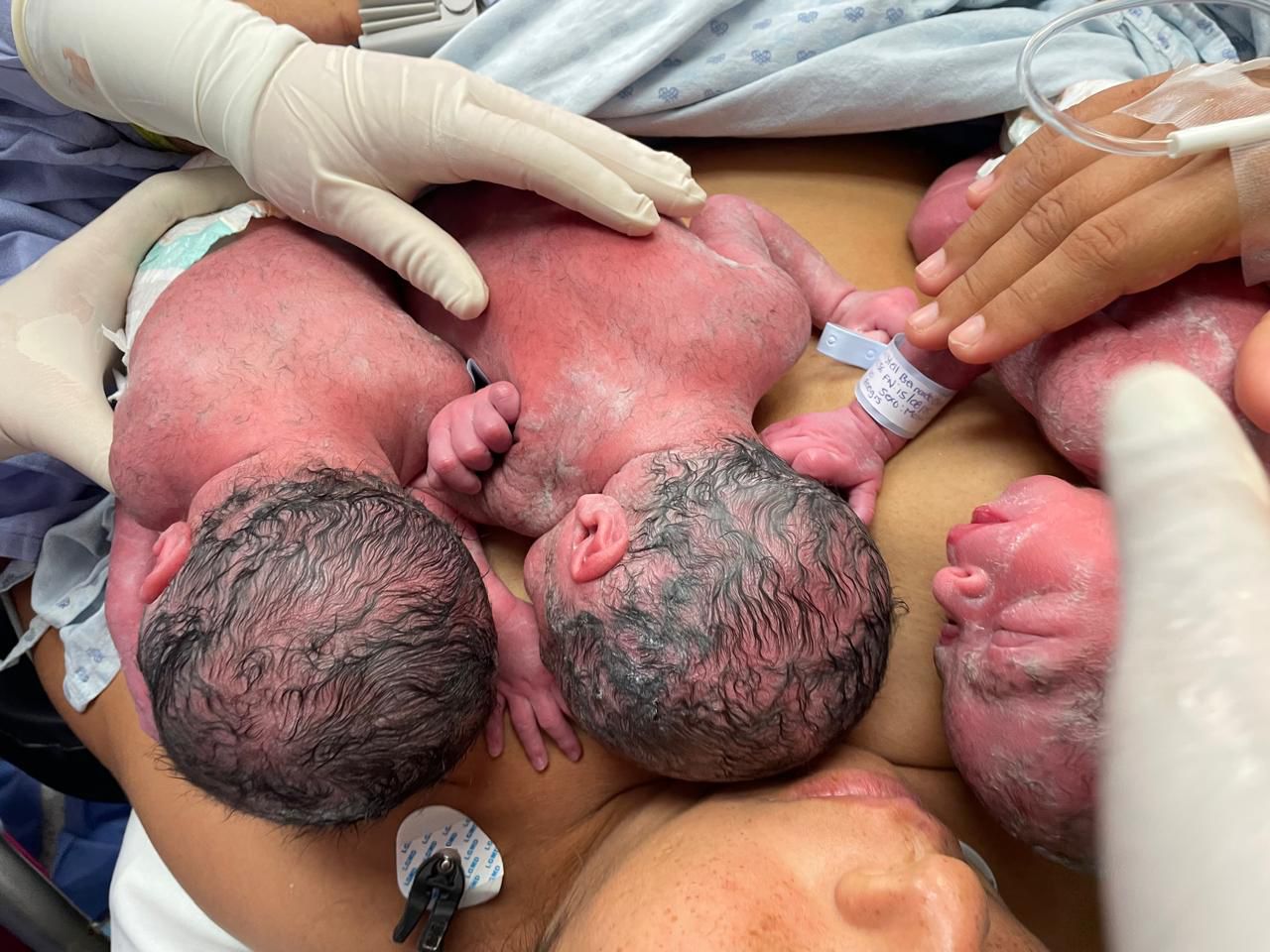 Nacen trillizos varones en el HRAE de la Mujer; madre e hijos son dados de alta en buen estado de salud