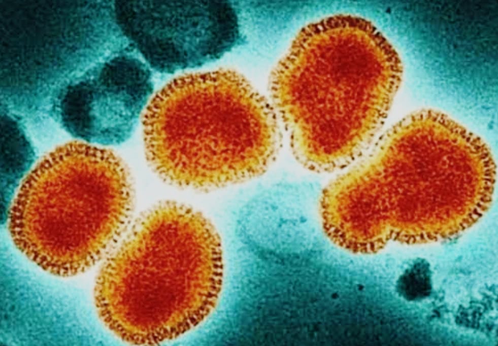 Alerta por influenza intensa: autoridades llaman a tomar precauciones en temporada invernal